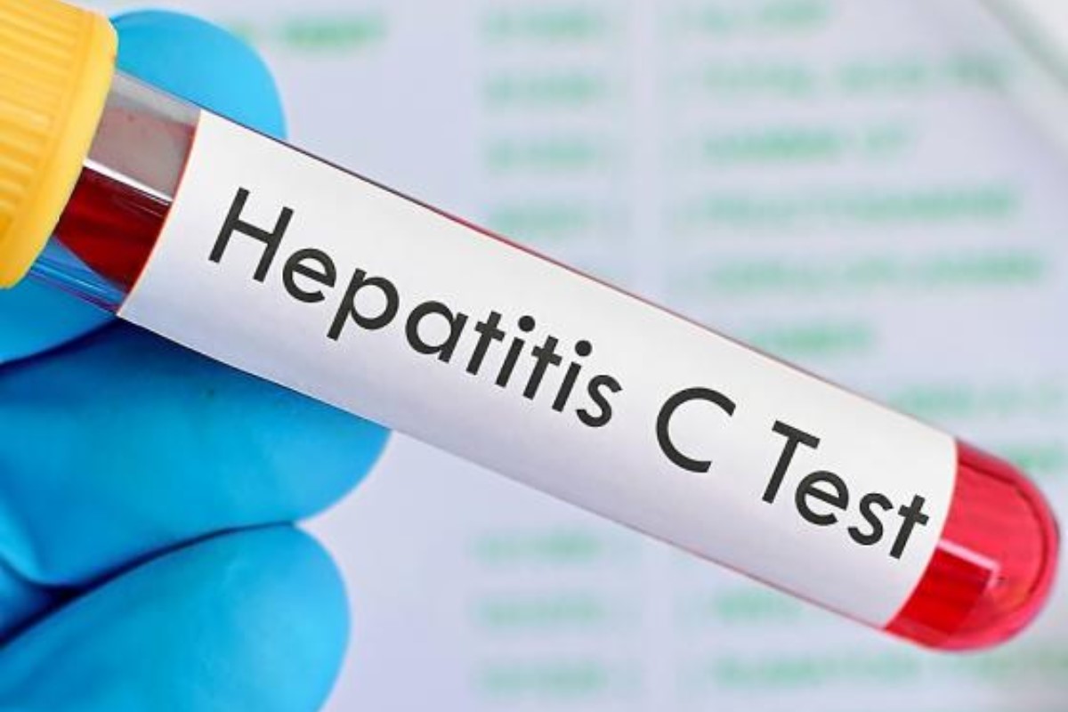Test de hepatitis C.